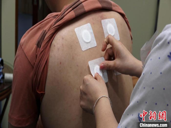 图为医生正在为民众贴“三伏贴”。 唐蔚晴 摄
